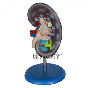 “康為醫療”腎解剖模型1件