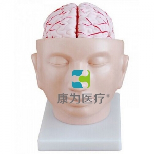 “康為醫療”頭部附腦動脈模型