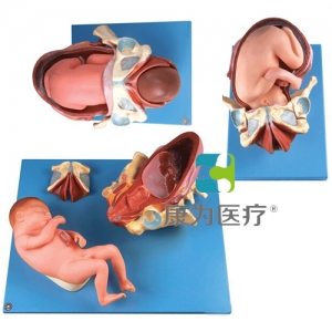 “康為醫療”足月胎兒分娩過程模型