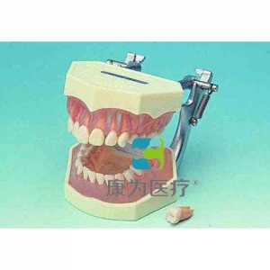 “康為醫療”可拆成人牙頜模型