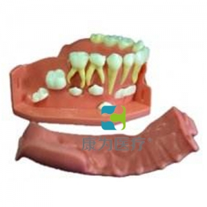 “康為醫療”牙列發育模型B