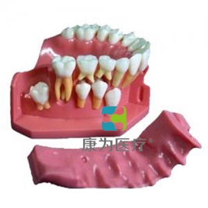 “康為醫療”牙列發育模型C