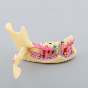 “康為醫療”下頜骨模型