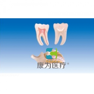 “康為醫療”牙列與磨齒模型