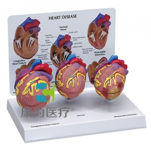 “康為醫療”醫患關系溝通模型-正常心臟解剖模型 （醫學指導模型）