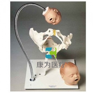 帶有胎兒頭的骨盆模型
